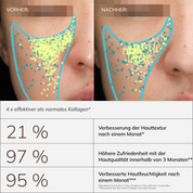 Collagen Activator vorher und nachher