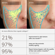 Collagen Activator