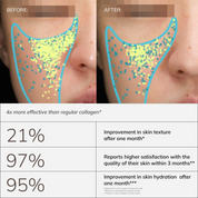 Collagen Activator
