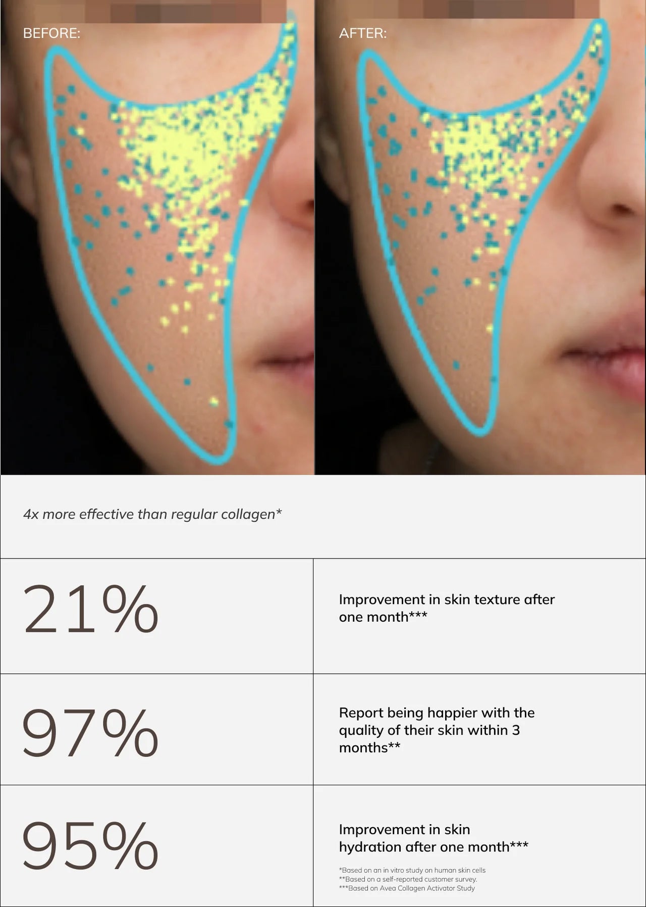 Collagen_Carousel_LANG_EN.webp