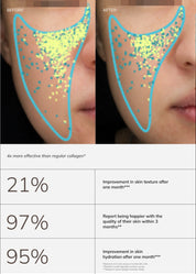 Collagen_Carousel_LANG_EN.webp